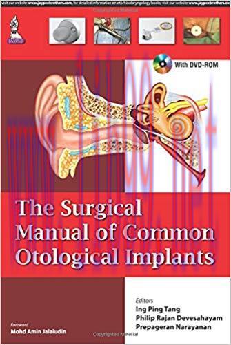 [PDF]The Surgical Manual of Common Otological Implants