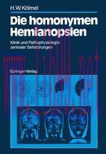 [PDF]Die homonymen Hemianopsien: Klinik und Pathophysiologie zentraler Sehstörungen