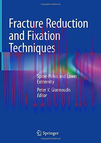 [AME]Fracture Reduction and Fixation Techniques: Spine-Pelvis and Lower Extremity (Original PDF...