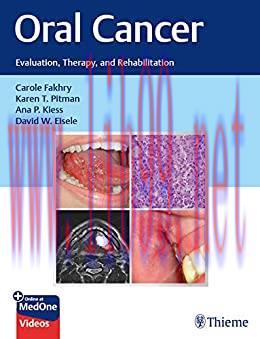 [PDF]Oral Cancer Evaluation, Therapy, and Rehabilitation PDF+VIDEOS