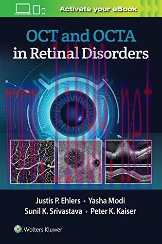 [AME]OCT and OCT Angiography in Retinal Disorders (ePub)