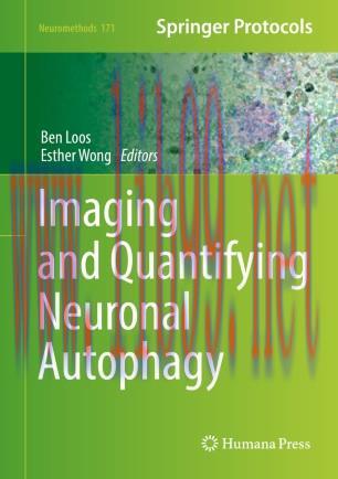 Imaging and Quantifying Neuronal Autophagy