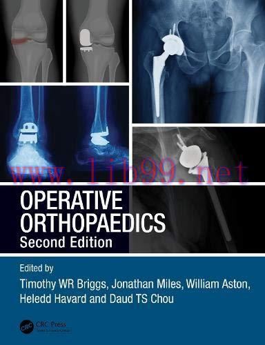 [AME]Operative Orthopaedics, 2ed (Original PDF)