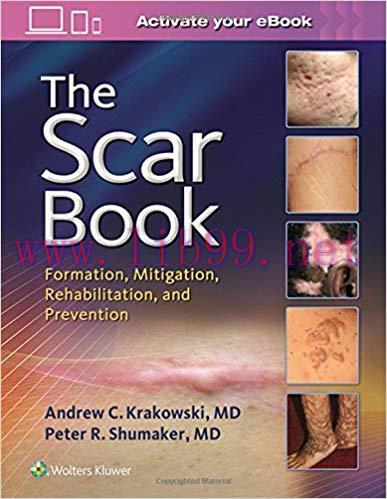 [EPUB]The Scar Book: Formation, Mitigation, Rehabilitation and Prevention