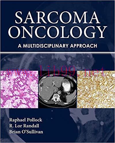 [PDF]Sarcoma Oncology A Multidisciplinary Approach