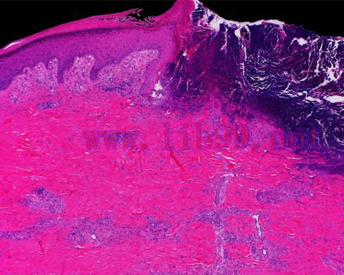 [AME]Mayo Clinic Wound Symposium: The Edges of Wound Care 2023 (Videos+Assessment Quiz)