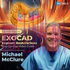 [AME]OHI-S EXOCAD Implant Restorations - Step-by-step Video Guide 2023 (Videos)