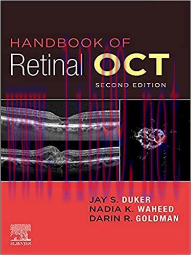 [PDF]Handbook of Retinal OCT Optical Coherence Tomography 2nd Edition E-Book