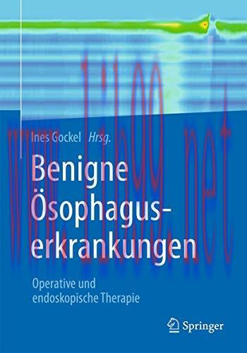 [AME]Benigne Ösophaguserkrankungen: Operative und endoskopische Therapie (German Edition) (Orig...