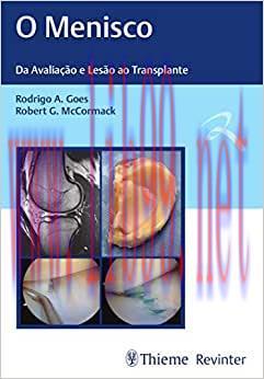 [AME]O Menisco: Da Avaliação e Lesão ao Transplante, 1st edition (Original PDF)