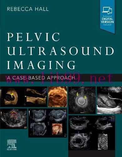 [AME]Pelvic Ultrasound Imaging: A Cased-Based Approach (True PDF+ToC+Index)