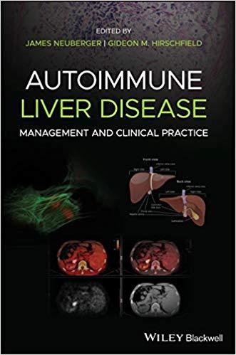 Autoimmune Liver Disease Management and Clinical Practice