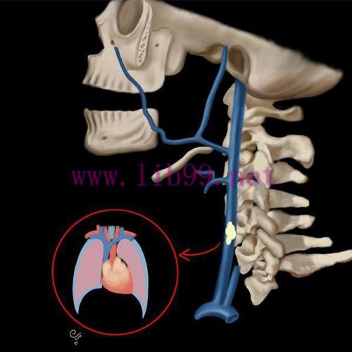 [AME]MRIOnline Emergency Series: Emergency Neuroimaging: Head, Neck & Spine 2021 (CME VIDEOS)