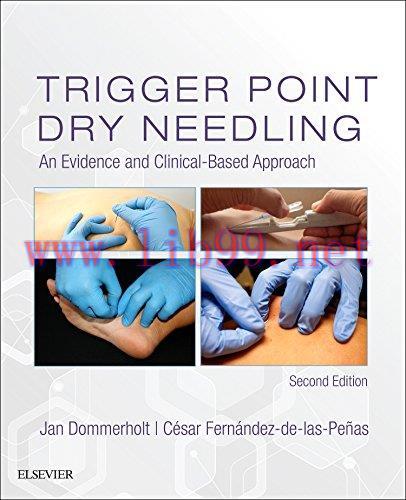 [AME]Trigger Point Dry Needling: An Evidence and Clinical-Based Approach, 2ed (PDF)