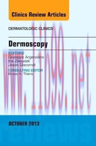 [AME]Dermoscopy, an Issue of Dermatologic Clinics, 1e (The Clinics: Dermatology)