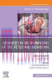 [AME]Advances in Neuroimaging of the Fetus and Newborn, An Issue of Clinics in Perinatology (Vo...