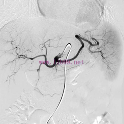 [AME]NYU Langone Vascular and Interventional Radiology Review and Update_ 2023 (Videos)