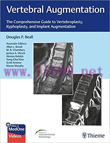 [PDF]Vertebral Augmentation: The Comprehensive Guide to Vertebroplasty, Kyphoplasty, and Implan...