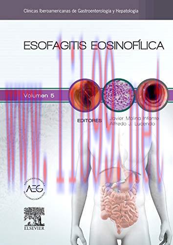 [AME]Esofagitis eosinofílica: Clínicas Iberoamericanas de Gastroenterología y Hepatología (Span...