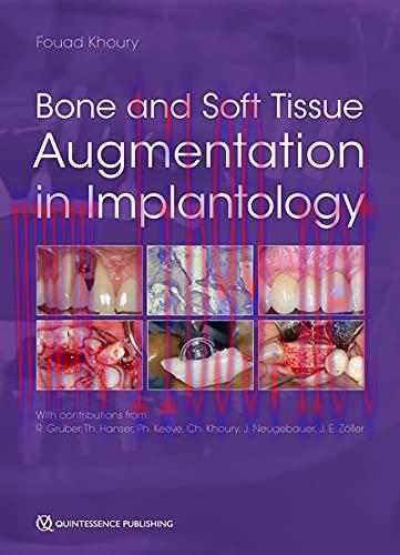 [AME]Bone and Soft Tissue Augmentation in Implantology (ePub+Converted PDF)
