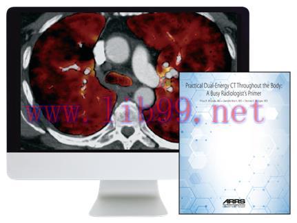 [AME]ARRS Practical Dual-Energy CT Throughout the Body 2021 (CME VIDEOS)