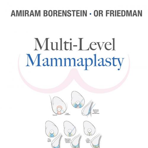 Multi-level Mammaplasty_ Anatomical Support And Re-shaping Of The Breast - Amiram Borenstein & ...