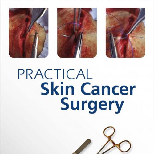 PRACTICAL SKIN CANCER SURGERY-Mileham Hayes OAM MB BS (Qld) FRCP (Edin) FRCP (Lon)_