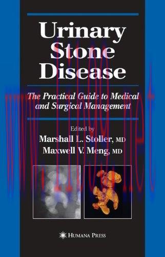 [FOX-Ebook]Urinary Stone Disease: The Practical Guide to Medical and Surgical Management