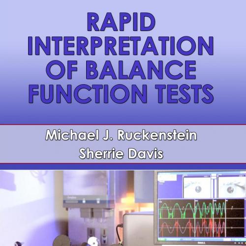 Rapid Interpretation of Balance Function Tests