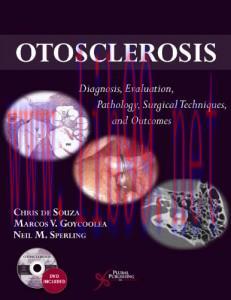 [AME]Otosclerosis: Diagnosis, Evaluation, Pathology, Surgical Techniques, and Outcomes