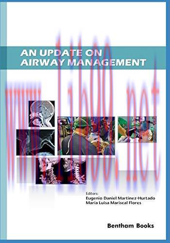 AN UPDATE_ON AIRWAY MANAGEMENT