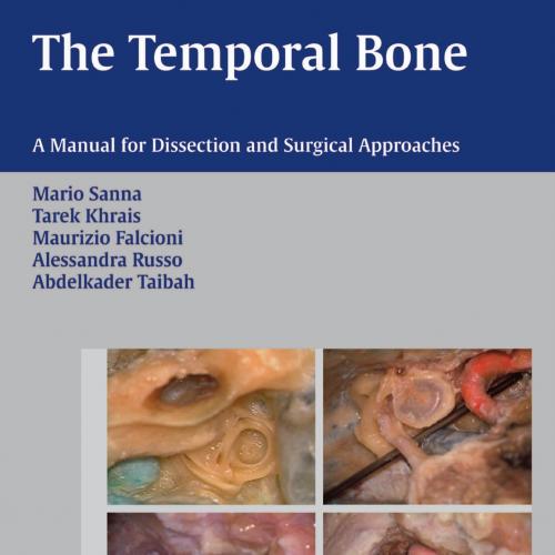 Temporal Bone-A Manual for Disection and Surgical Approaches, The