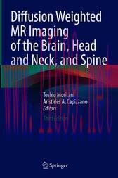 [AME]Diffusion-Weighted MR Imaging of the Brain, Head and Neck, and Spine 3rd Edition (Original...