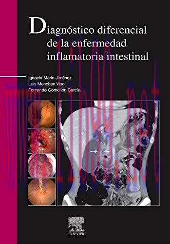 [AME]Diagnóstico diferencial de la enfermedad inflamatoria intestinal (Spanish Edition) (Origin...