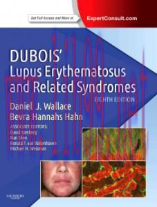 [AME]Dubois’ Lupus Erythematosus and Related Syndromes, 8th Edition (Original PDF)