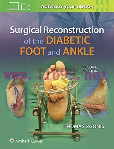 [AME]Surgical Reconstruction of the Diabetic Foot and Ankle, 2nd Edition (EPUB)