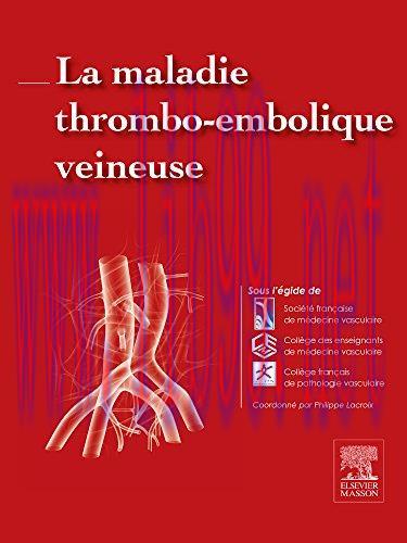 [AME]La maladie thrombo-embolique veineuse (Hors collection) (French Edition) (Original PDF)