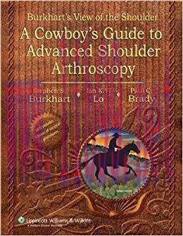 (PDF)Burkhart’s View of the Shoulder: A Cowboy’s Guide to Advanced Shoulder Arthroscopy 1st Edi...