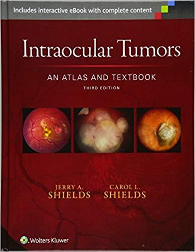 Intraocular Tumors - An Atlas and Textbook, 3rd Edition+EPUB版