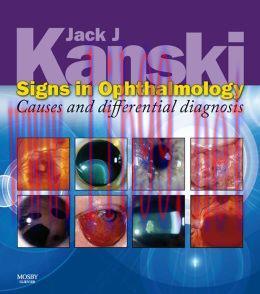 [AME]Signs in Ophthalmology: Causes and Differential Diagnosis (Kanski)