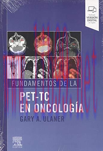 [AME]Fundamentos de la PET-TC en oncología (Spanish Edition) (True PDF)