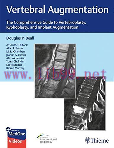 [AME]Vertebral Augmentation: The Comprehensive Guide to Vertebroplasty, Kyphoplasty, and Implan...