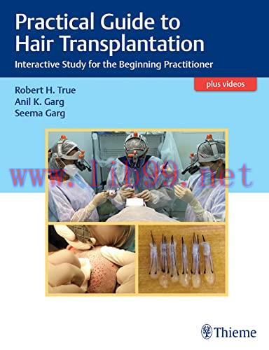 [AME]Practical Guide to Hair Transplantation: Interactive Study for the Beginning Practitioner ...
