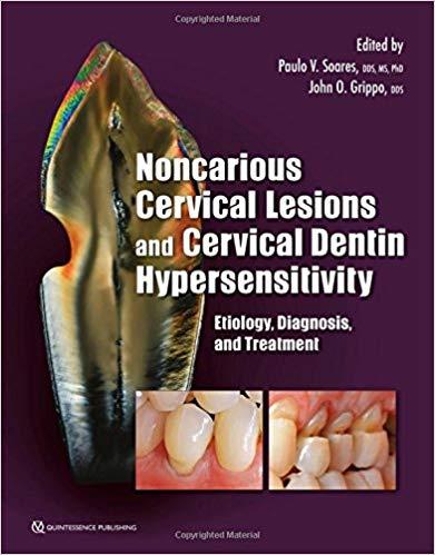Noncarious Cervical Lesions and Cervical Dentin Hypersensitivity Etiology, Diagnosis, and Treat...