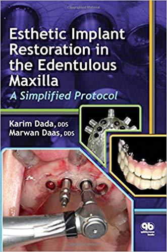 Esthetic Implant Restoration in the Edentulous Maxilla A Simplified Protocol