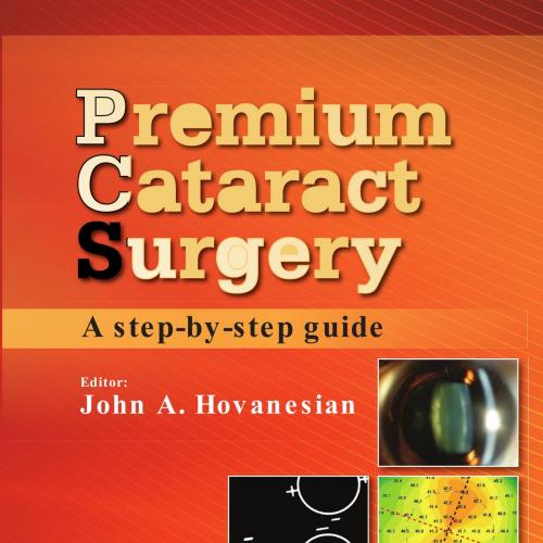 Premium Cataract Surgery A Step By Step Guide