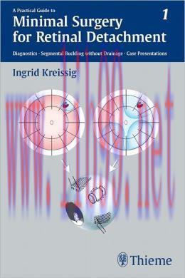 [AME]A Practical Guide to Minimal Surgery for Retinal Detachment, Volume 1