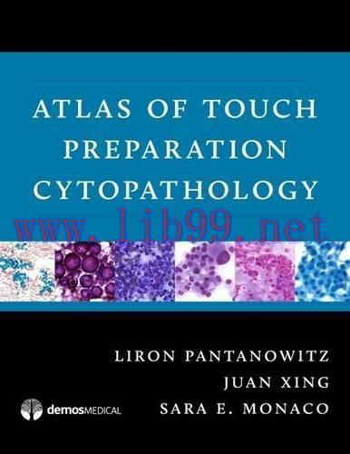 [AME]Atlas of Touch Preparation Cytopathology (PDF)