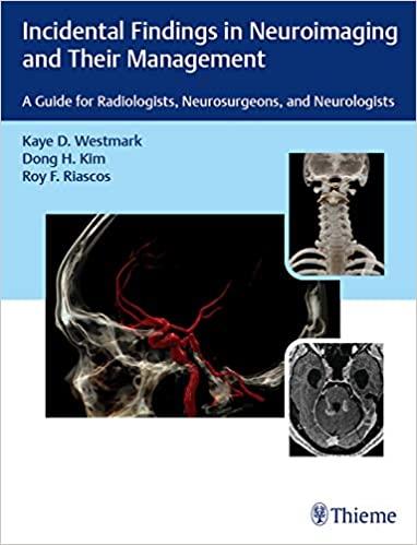 Incidental Findings in Neuroimaging and Their Management