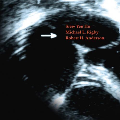 Echocardiography in Congenital Heart Disease Made Simple (258 pages) - Siew Yen Ho, Michael L. ...